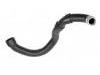 Radiator hose:203 501 27 82